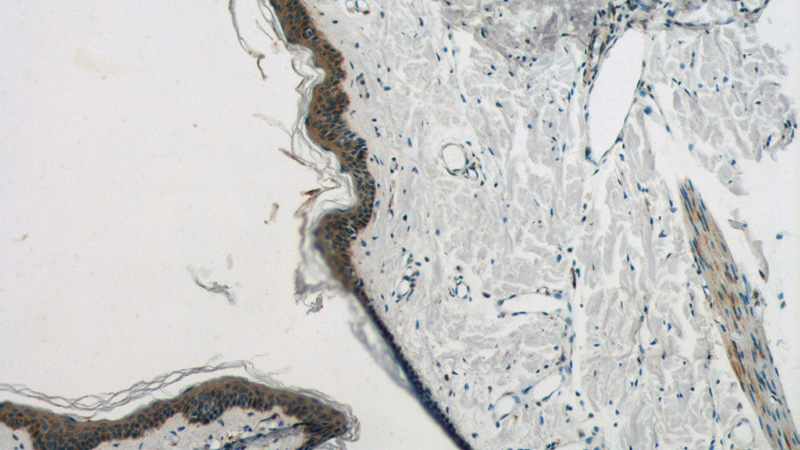 Immunohistochemistry of paraffin-embedded human skin tissue slide using Catalog No:109709(CYP4F8 Antibody) at dilution of 1:50 (under 10x lens)