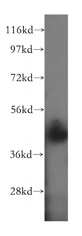 human brain tissue were subjected to SDS PAGE followed by western blot with Catalog No:113054(NDEL1 antibody) at dilution of 1:500