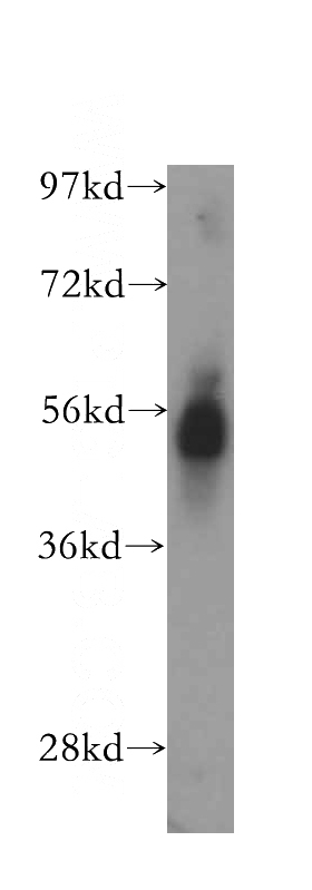 PC-3 cells were subjected to SDS PAGE followed by western blot with Catalog No:110069(DPP4 antibody) at dilution of 1:500
