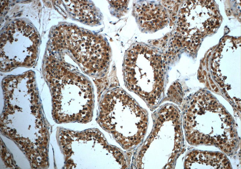 Immunohistochemistry of paraffin-embedded human testis slide using Catalog No:116103(TMEM168 Antibody) at dilution of 1:50