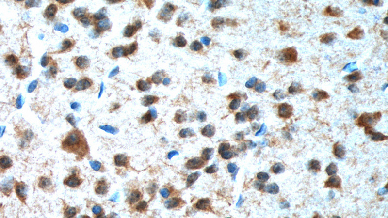 Immunohistochemistry of paraffin-embedded mouse brain tissue slide using Catalog No:107783(ADORA1 Antibody) at dilution of 1:100 (under 40x lens). heat mediated antigen retrieved with Tris-EDTA buffer(pH9).