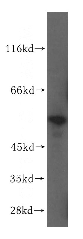 HepG2 cells were subjected to SDS PAGE followed by western blot with Catalog No:113211(NPEPL1 antibody) at dilution of 1:50