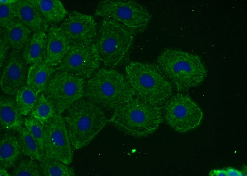 Immunofluorescent analysis of A431 cells using Catalog No:116252(TOR1AIP2 Antibody) at dilution of 1:25 and Alexa Fluor 488-congugated AffiniPure Goat Anti-Rabbit IgG(H+L)