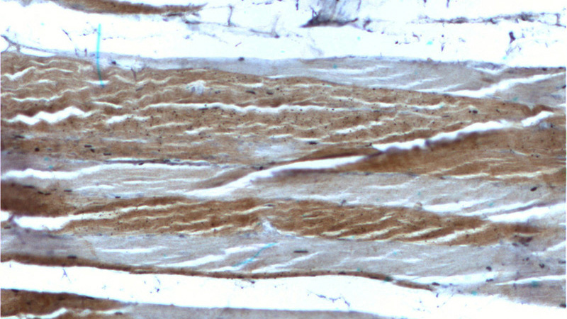 Immunohistochemistry of paraffin-embedded human skeletal muscle tissue slide using Catalog No:107318(Myosin 2a Antibody) at dilution of 1:100 (under 10x lens)