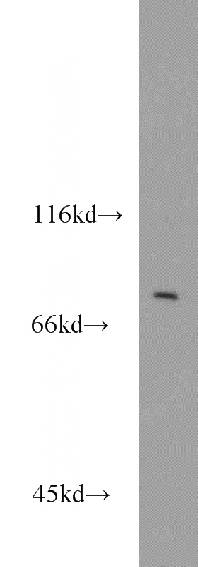 HepG2 cells were subjected to SDS PAGE followed by western blot with Catalog No:108368(BBS10 antibody) at dilution of 1:800