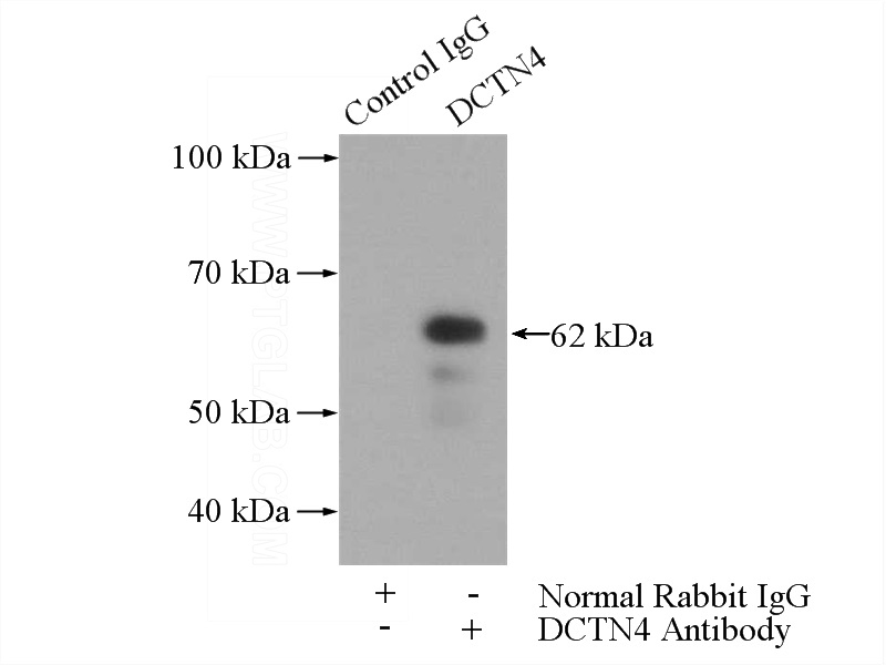 IP Result of anti-DCTN4 (IP:Catalog No:109759, 4ug; Detection:Catalog No:109759 1:700) with Jurkat cells lysate 2800ug.