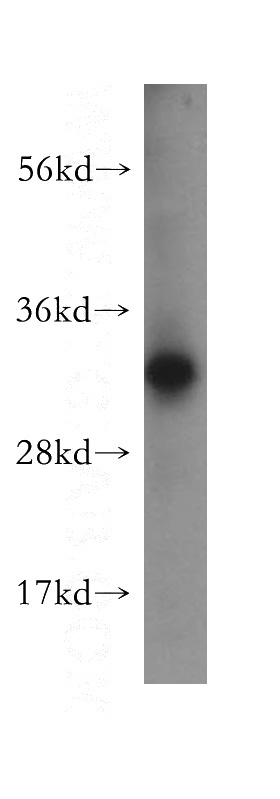 HEK-293 cells were subjected to SDS PAGE followed by western blot with Catalog No:109233(CHMP2A antibody) at dilution of 1:300