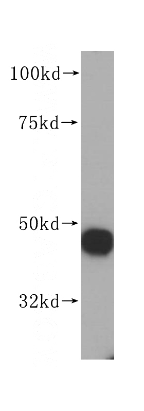 HeLa cells were subjected to SDS PAGE followed by western blot with Catalog No:114769(RNMTL1 antibody) at dilution of 1:500