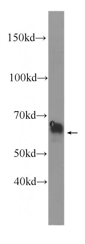 HepG2 cells were subjected to SDS PAGE followed by western blot with Catalog No:107476(ALPP Antibody) at dilution of 1:1000