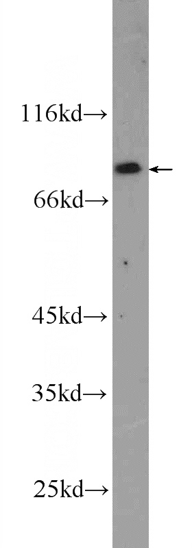 SH-SY5Y cells were subjected to SDS PAGE followed by western blot with Catalog No:109507(CPEB4 Antibody) at dilution of 1:600