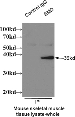IP result of EMD antibody (Catalog No:110237 for IP and Detection) with mouse skeletal muscle tissue lysate.