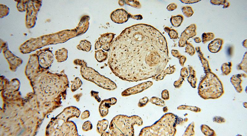 Immunohistochemical of paraffin-embedded human placenta using Catalog No:109880(DBR1 antibody) at dilution of 1:100 (under 10x lens)