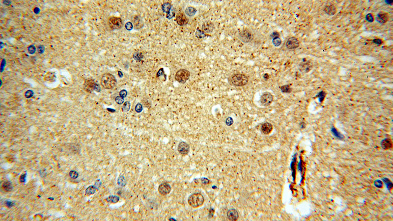 Immunohistochemical of paraffin-embedded human brain using Catalog No:115467(SNUPN antibody) at dilution of 1:100 (under 40x lens)