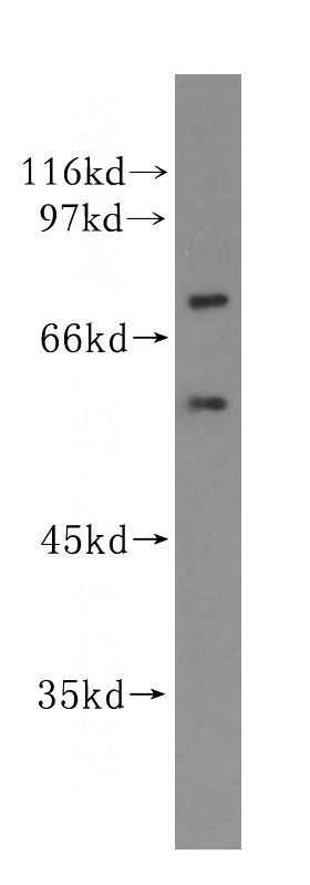 HepG2 cells were subjected to SDS PAGE followed by western blot with Catalog No:111060(GPBP1L1 antibody) at dilution of 1:500