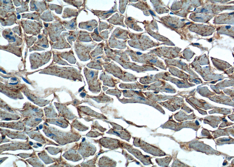 Immunohistochemistry of paraffin-embedded human heart tissue slide using Catalog No:113345(OLR1 Antibody) at dilution of 1:200 (under 40x lens).