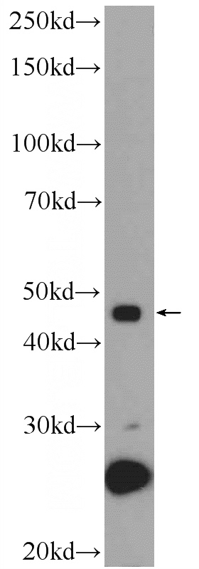 U-937 cells were subjected to SDS PAGE followed by western blot with Catalog No:116999(ZNF506 Antibody) at dilution of 1:300