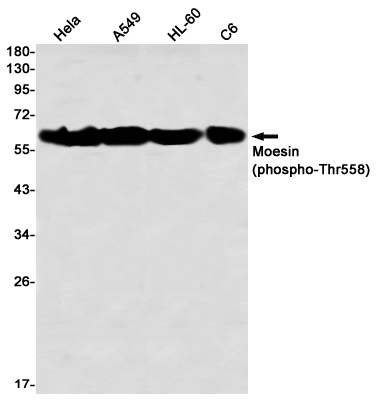 Western blot detection of Moesin (phospho-Thr558) in Hela,A549,HL-60,C6 using Moesin (phospho-Thr558) Rabbit mAb(1:1000 diluted)