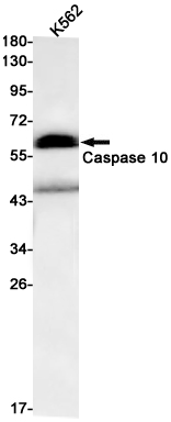 Western blot detection of Caspase 10 in K562 cell lysates using Caspase 10 Rabbit pAb(1:1000 diluted).Predicted band size:59kDa.Observed band size:59kDa.
