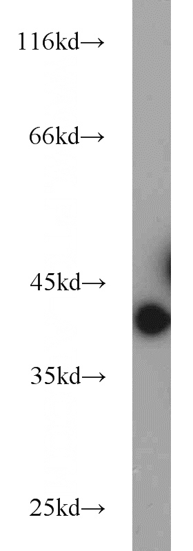 mouse brain tissue were subjected to SDS PAGE followed by western blot with Catalog No:110999(GNB5 antibody) at dilution of 1:1000