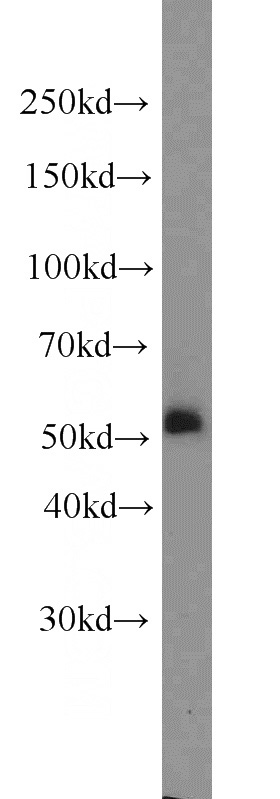 mouse brain tissue were subjected to SDS PAGE followed by western blot with Catalog No:113312(CYBB antibody) at dilution of 1:600