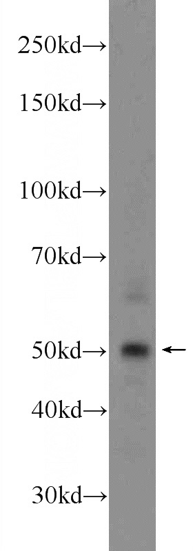HeLa cells were subjected to SDS PAGE followed by western blot with Catalog No:109631(CCDC49 Antibody) at dilution of 1:1000