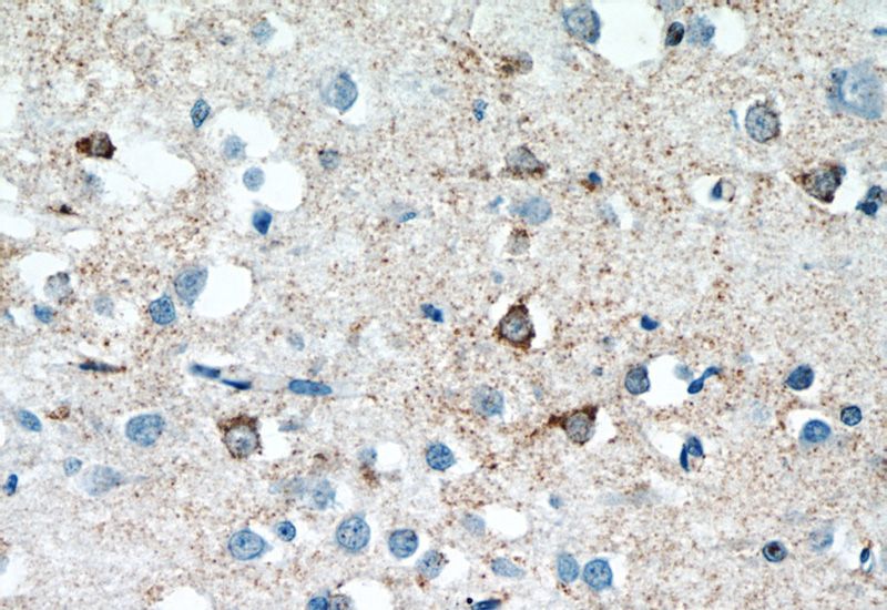 Immunohistochemistry of paraffin-embedded human brain tissue slide using Catalog No:115449(SNAPIN Antibody) at dilution of 1:50 (under 40x lens)