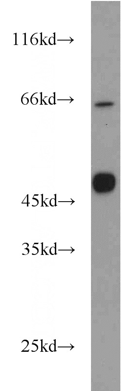A375 cells were subjected to SDS PAGE followed by western blot with Catalog No:112383(MAGEA8 antibody) at dilution of 1:1000