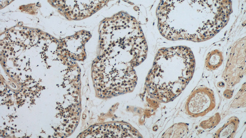 Immunohistochemistry of paraffin-embedded human testis tissue slide using Catalog No:108372(BBS5 Antibody) at dilution of 1:50 (under 10x lens)
