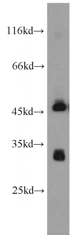 SGC-7901 cells were subjected to SDS PAGE followed by western blot with Catalog No:113639(PDSS2 antibody) at dilution of 1:300