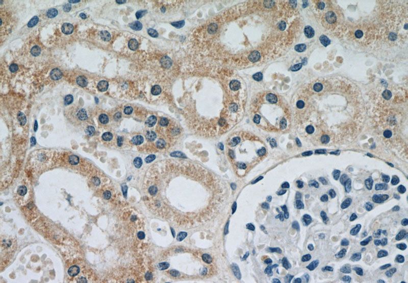 Immunohistochemical of paraffin-embedded human kidney using Catalog No:107326(NDUFS5 antibody) at dilution of 1:50 (under 40x lens)