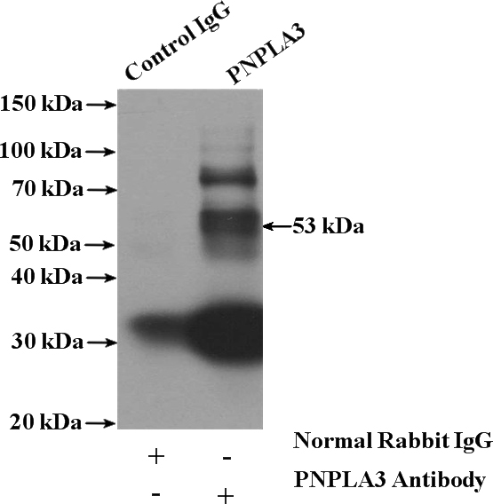 IP Result of anti-PNPLA3 (IP:Catalog No:113981, 4ug; Detection:Catalog No:113981 1:100) with HepG2 cells lysate 1000ug.