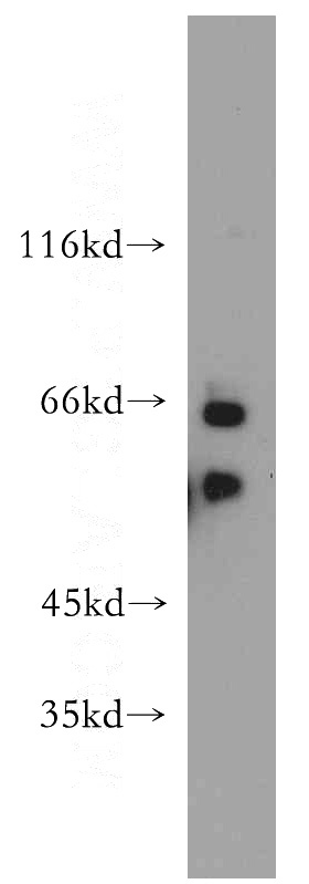 HeLa cells were subjected to SDS PAGE followed by western blot with Catalog No:109528(CPSF6 antibody) at dilution of 1:100