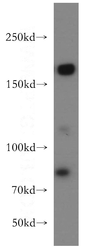 HeLa cells were subjected to SDS PAGE followed by western blot with Catalog No:116247(TOP2A-Specific antibody) at dilution of 1:400
