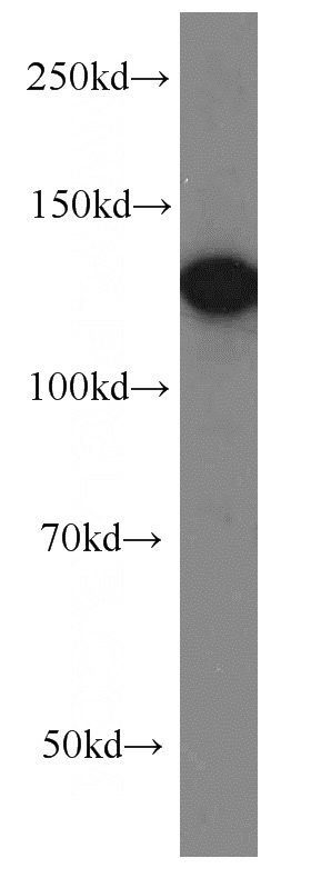 A2780 cells were subjected to SDS PAGE followed by western blot with Catalog No:113919(PKN2 antibody) at dilution of 1:500