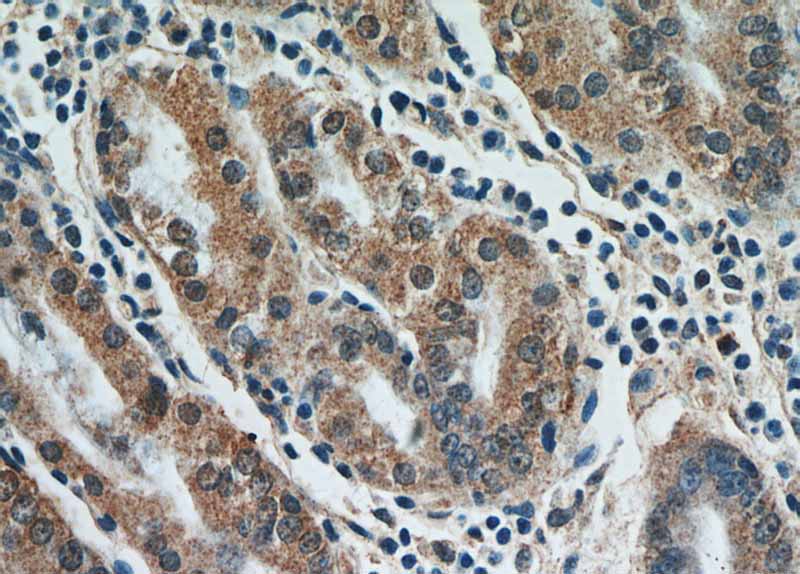 Immunohistochemical of paraffin-embedded human stomach using Catalog No:110456(FAM101A antibody) at dilution of 1:50 (under 40x lens)