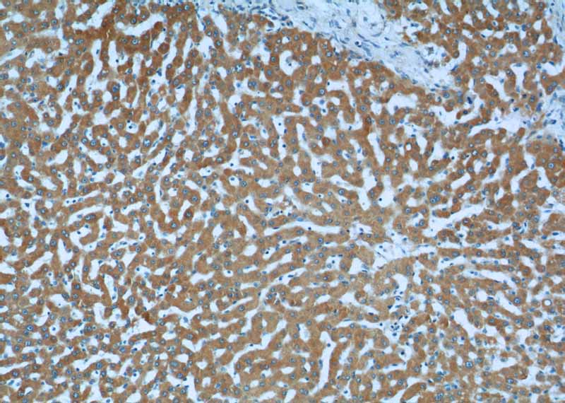 Immunohistochemistry of paraffin-embedded human liver tissue slide using Catalog No:112355(LSS Antibody) at dilution of 1:50 (under 10x lens)