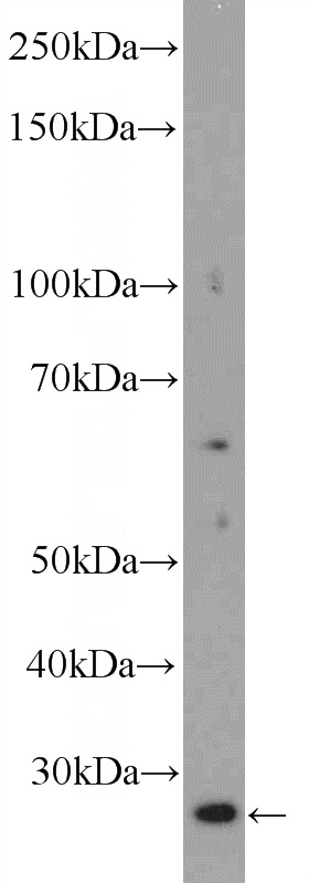 HepG2 cells were subjected to SDS PAGE followed by western blot with Catalog No:115977(TAF11 Antibody) at dilution of 1:300