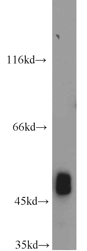 HeLa cells were subjected to SDS PAGE followed by western blot with Catalog No:110647(FH antibody) at dilution of 1:1000