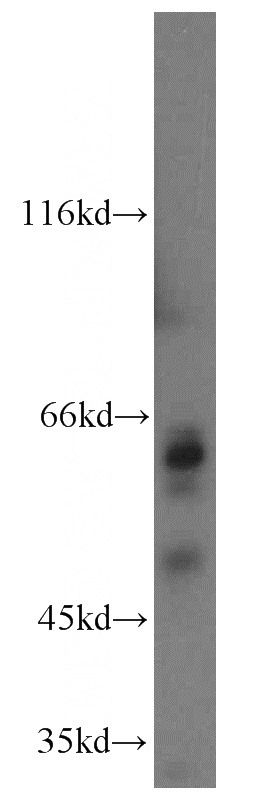 mouse embryo tissue were subjected to SDS PAGE followed by western blot with Catalog No:115919(TCTN1 antibody) at dilution of 1:800