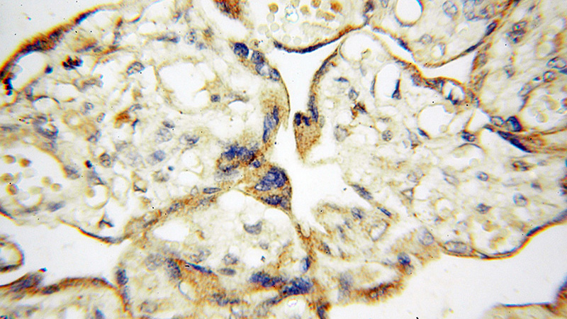 Immunohistochemical of paraffin-embedded human placenta using Catalog No:114316(PTPN14 antibody) at dilution of 1:50 (under 40x lens)