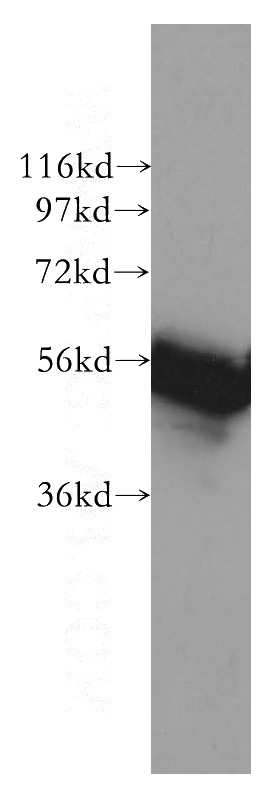 Jurkat cells were subjected to SDS PAGE followed by western blot with Catalog No:114513(RAD23A antibody) at dilution of 1:500