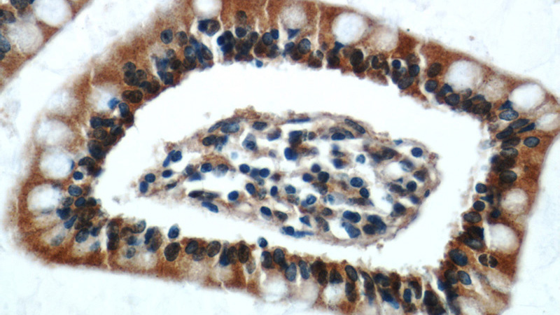 Immunohistochemical of paraffin-embedded human small intestine using Catalog No:115859(TAX1BP3 antibody) at dilution of 1:50 (under 40x lens)