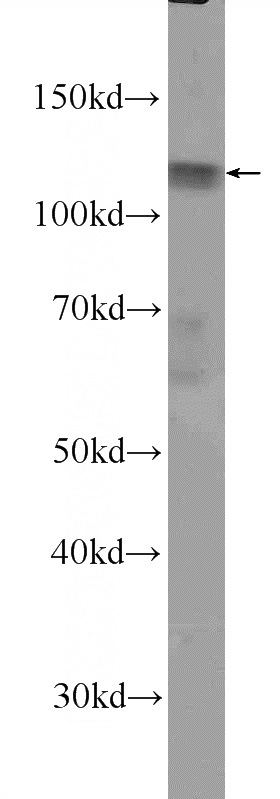 K-562 cells were subjected to SDS PAGE followed by western blot with Catalog No:109947(DIS3L Antibody) at dilution of 1:100