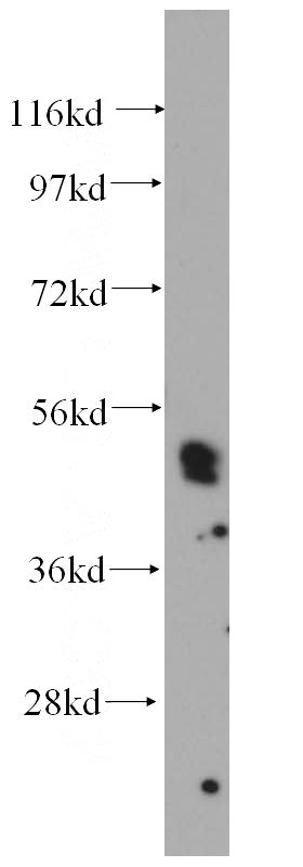 human placenta tissue were subjected to SDS PAGE followed by western blot with Catalog No:111435(HLX antibody) at dilution of 1:500