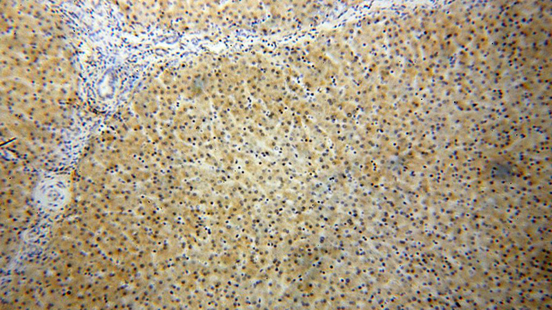 Immunohistochemical of paraffin-embedded human liver using Catalog No:109700(CYP3A4 antibody) at dilution of 1:50 (under 10x lens)
