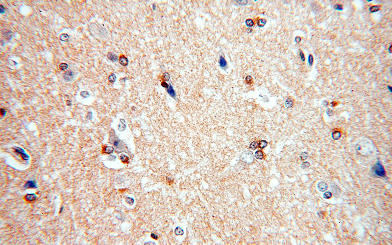 Immunohistochemical of paraffin-embedded human brain using Catalog No:110463(FAM118B antibody) at dilution of 1:100 (under 40x lens)
