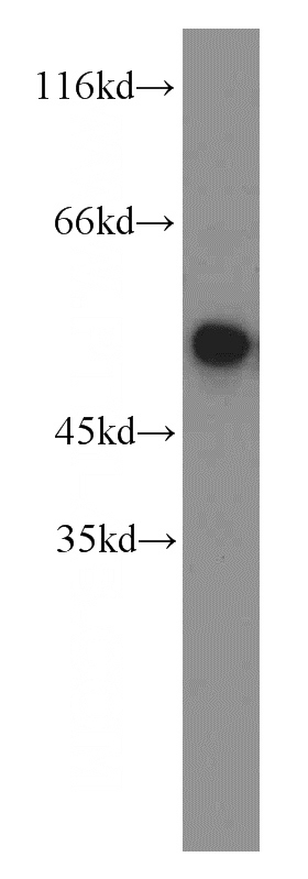 K-562 cells were subjected to SDS PAGE followed by western blot with Catalog No:110675(FKBP5 antibody) at dilution of 1:1000
