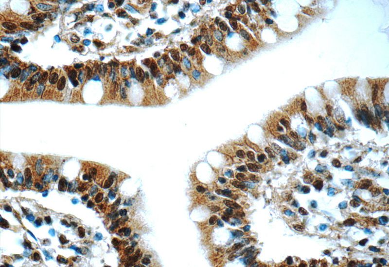 Immunohistochemistry of paraffin-embedded human small intestine tissue slide using Catalog No:111505(hnRNP-E1 Antibody) at dilution of 1:50 (under 40x lens)