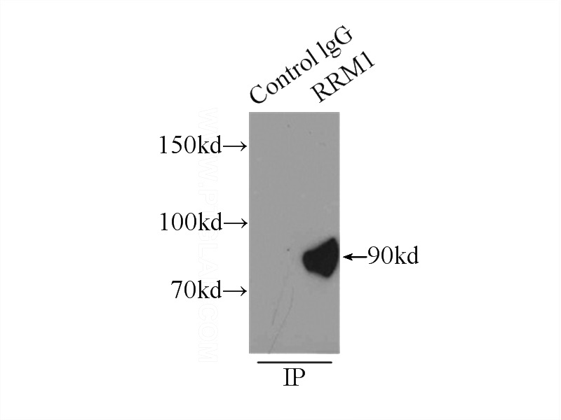 IP Result of anti-RRM1 (IP:Catalog No:114923, 5ug; Detection:Catalog No:114923 1:800) with K-562 cells lysate 8000ug.