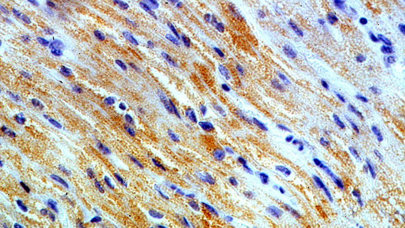 Immunohistochemical of paraffin-embedded human heart using Catalog No:109502(COX8A antibody) at dilution of 1:100 (under 40x lens)